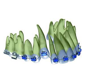 ARCHI PREFORMATI Ortodonzia Prodotti odontoiatrici DENTAL PROVIDES a Andria