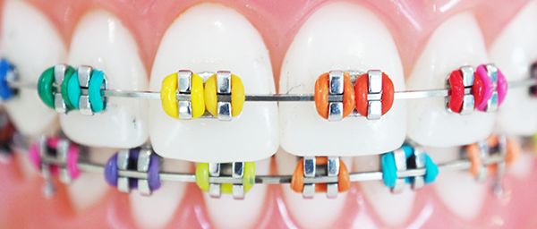 Ortodonzia Prodotti odontoiatrici DENTAL PROVIDES a Andria
