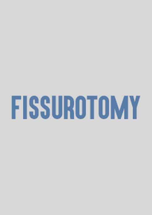 FRESE SS WHITE FISSUROTOMY Frese e abrasivi Prodotti odontoiatrici DENTAL PROVIDES a Andria
