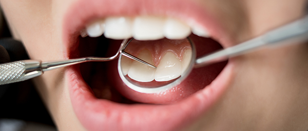 Conservativa Prodotti odontoiatrici DENTAL PROVIDES a Andria